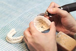 博多区でホワイトニングも行える歯科医院