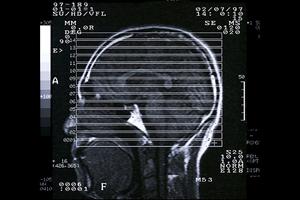 わかりやすい説明をする「ながしま歯科」
